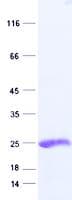 Human ABCC5 / MRP5 Protein (Recombinant His, N-Terminal)