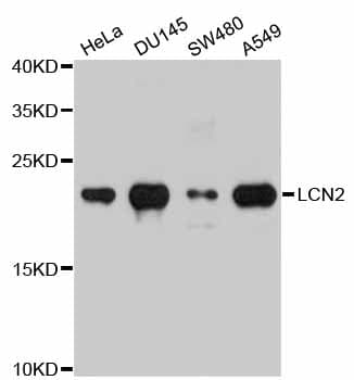 PathPlus™ Polyclonal Rabbit anti-Human LCN2 / Lipocalin 2 / NGAL Antibody (IHC, IF, WB)