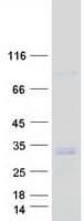 Human DGUOK / Deoxyguanosine Kinase Protein (Recombinant Myc-DDK (Flag))