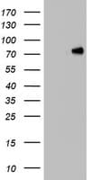 Monoclonal Mouse anti-Human HNRPM / HNRNPM Antibody (clone OTI3F3, aa1-261, IHC, WB)