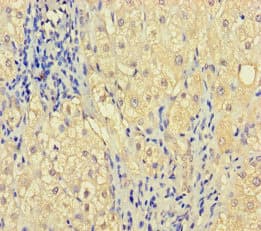 ZNF404 Antibody
