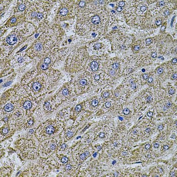 MAP1B Antibody