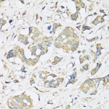 ATP2A3 / SERCA3 Antibody