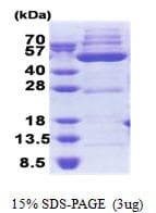 Human OXSM / KS Protein (Recombinant His)