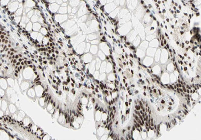 Polyclonal Rabbit anti-Human TAF1 Antibody (IHC, IF, WB)