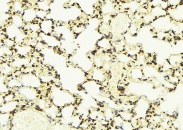 PYCARD / ASC / TMS1 Antibody
