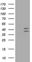 OTC Antibody (aa33-354, clone OTI2D9)