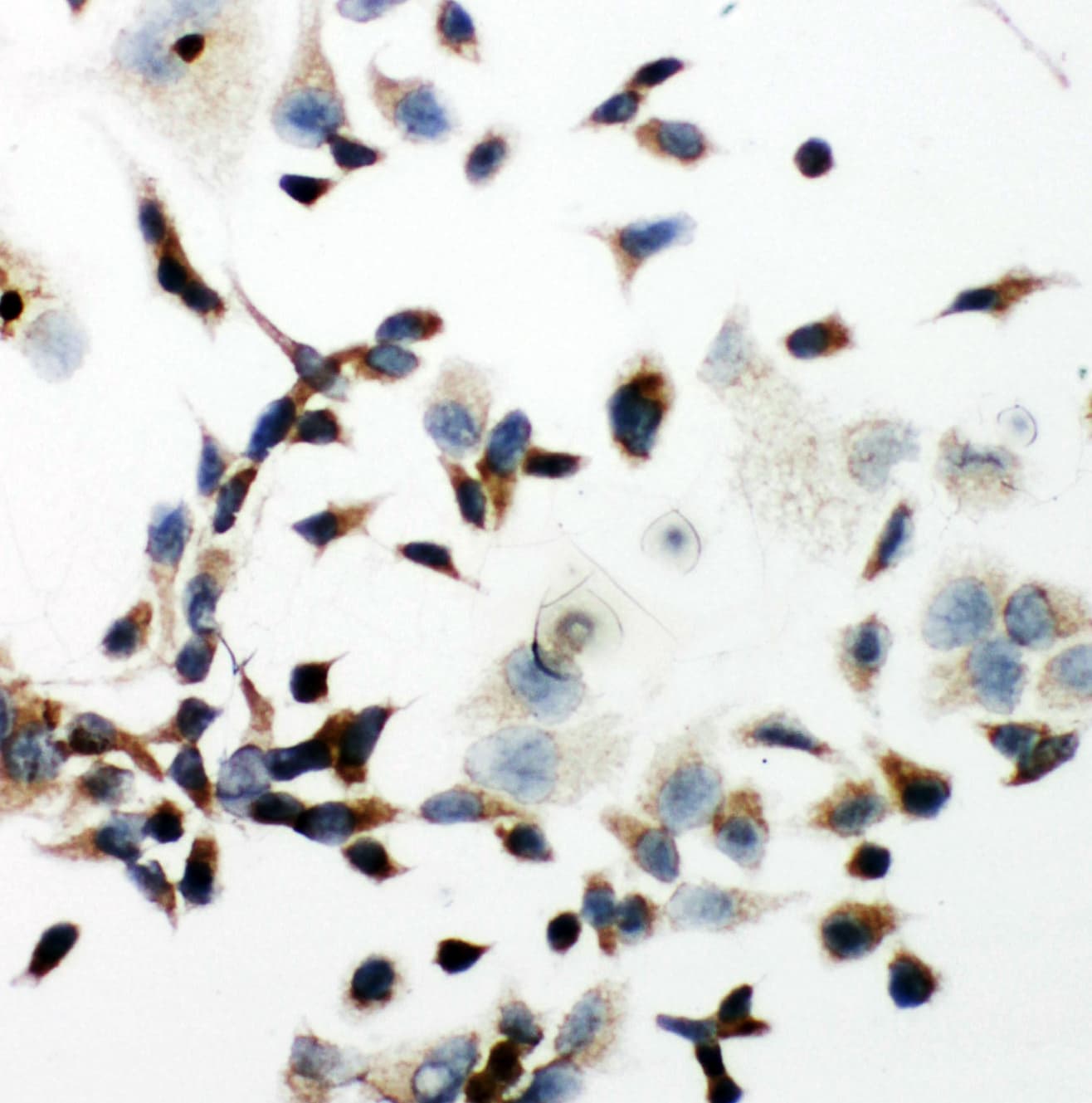KDR / VEGFR2 / FLK1 Antibody (aa454-469)