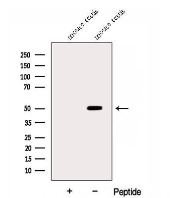 DYNC1LI2 Antibody
