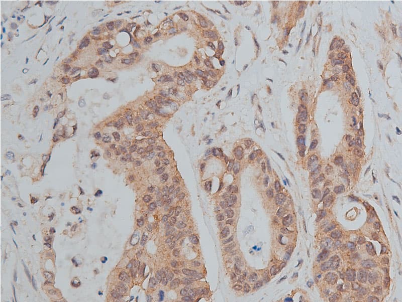 Polyclonal Rabbit anti-Human CDH1 / E Cadherin Antibody (IHC, IF, WB)