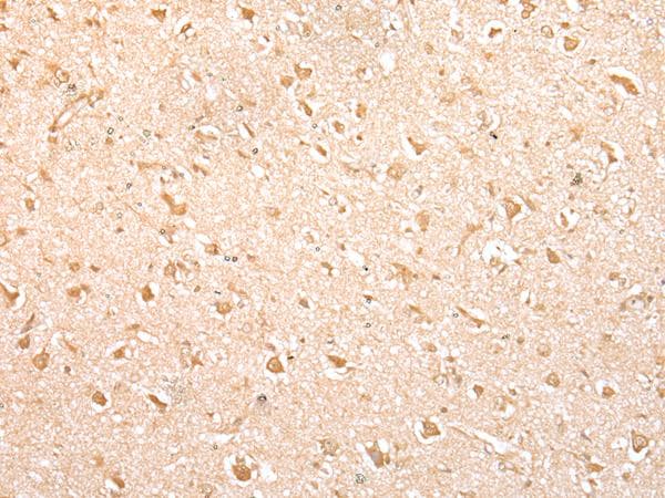 Polyclonal Rabbit anti-Human MED6 Antibody (IHC, WB)