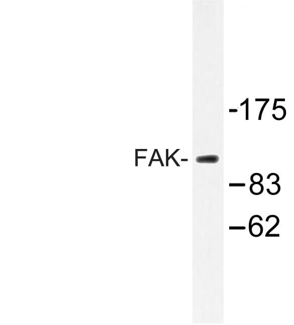 FAK / Focal Adhesion Kinase Antibody (Glu393)