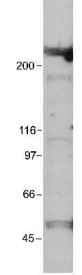 IHC-plus™ EP300 / p300 Antibody (aa1572-2371, clone RW109)