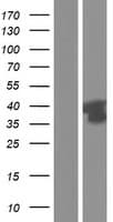 GPRC5D Protein (Over-Expression Lysate Myc-DDK (Flag))