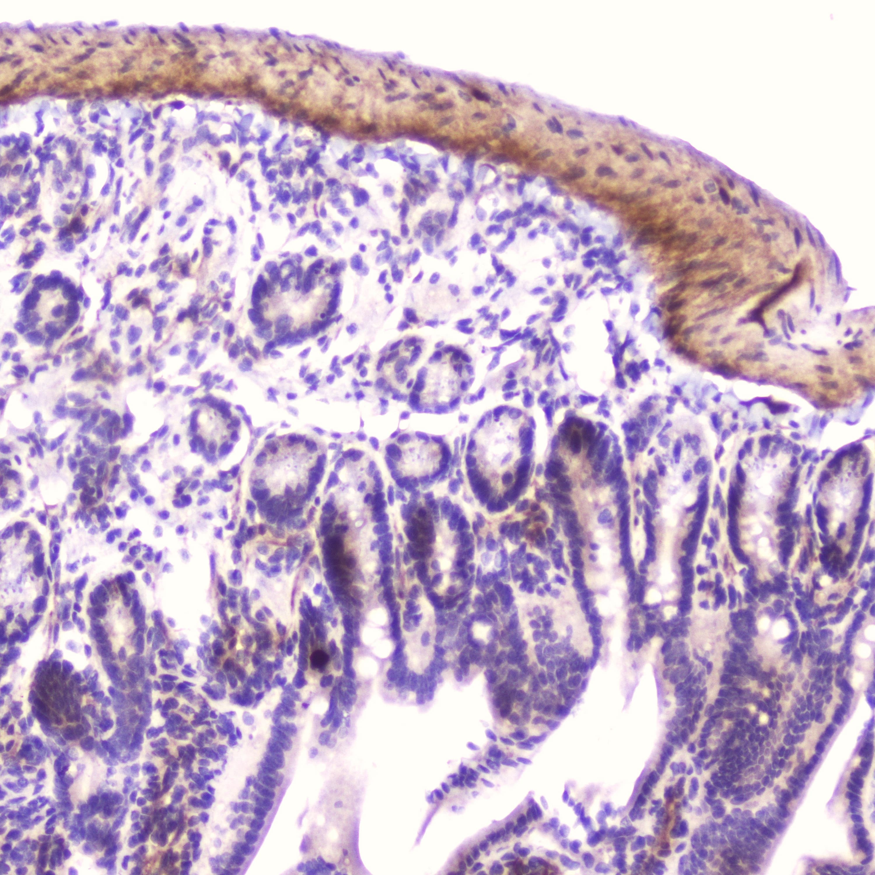 IGFBP2 / IGF-BP53 Antibody