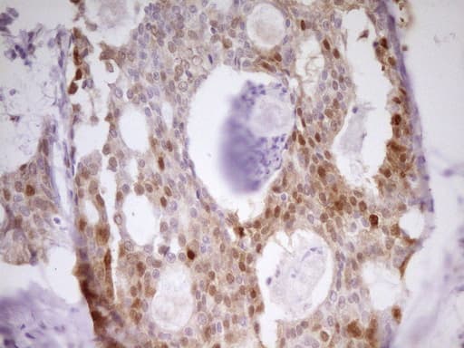 Monoclonal Mouse anti-Human PAPSS2 Antibody (clone OTI2E7, aa1-247, IHC, WB)