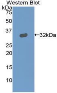 Polyclonal Rabbit anti-Cow GSN / Gelsolin Antibody (aa170-423, WB)