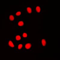 Polyclonal Rabbit anti-Human BRF1 Antibody (Internal, IHC, IF, WB)