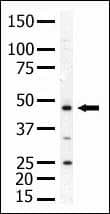 PIP4K2A / PIPK Antibody (aa107-139)