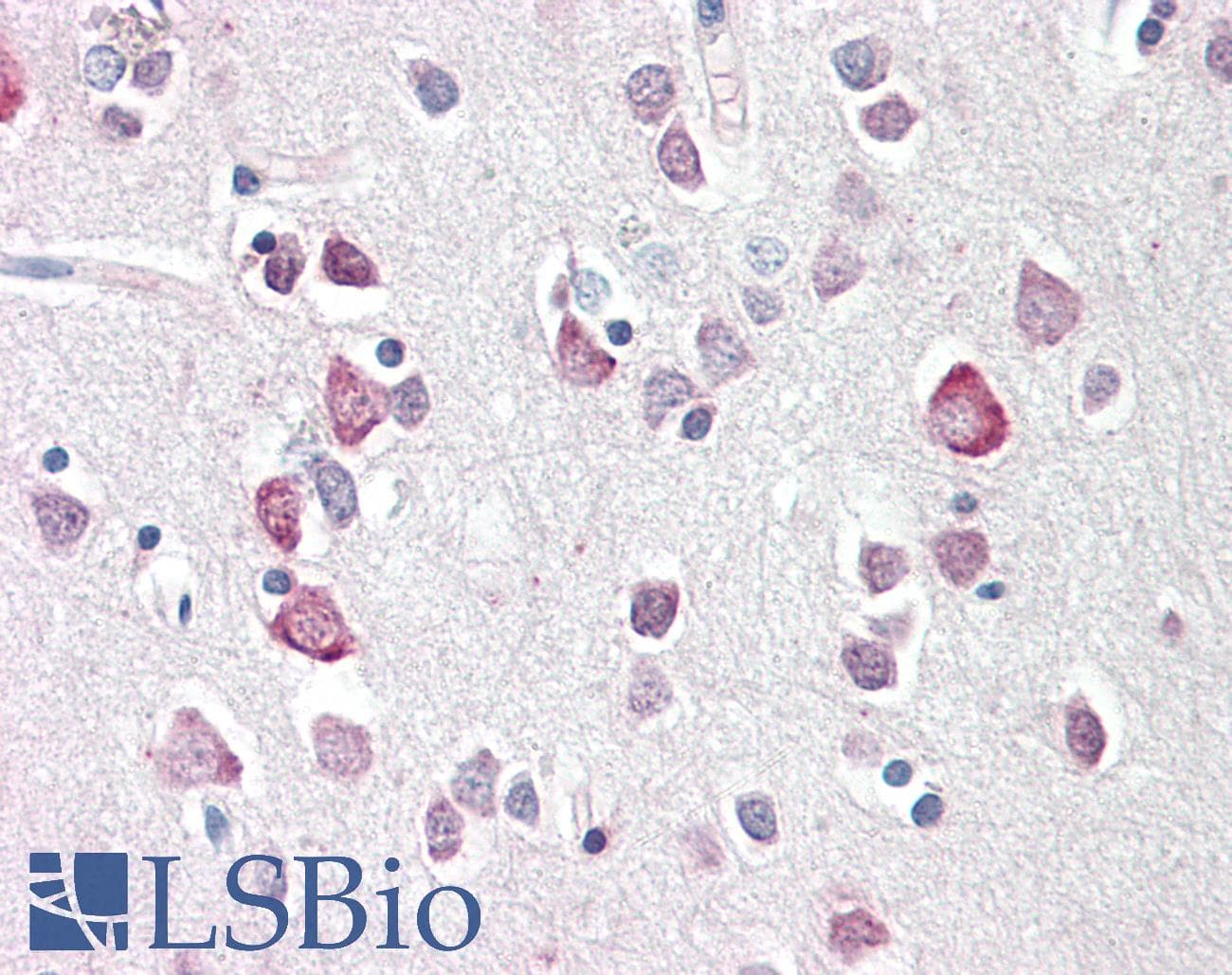 IHC-plus™ Polyclonal Rabbit anti-Human NEUROG2 / NGN2 / Neurogenin 2 Antibody (IHC, IF, WB)