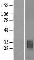 LPP3 / PPAP2B Protein (Over-Expression Lysate Myc-DDK (Flag))