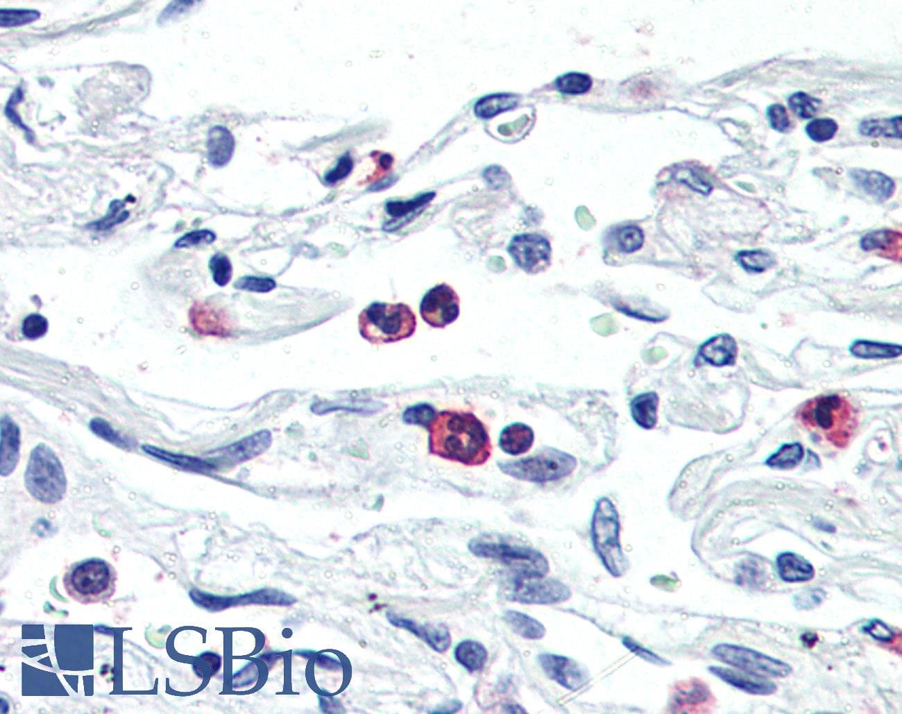 IHC-plus™ LGR6 Antibody (Internal)