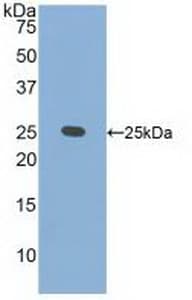 CRADD / RAIDD Antibody (aa1-199)