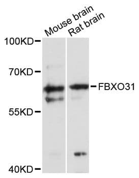 FBXO31 Antibody
