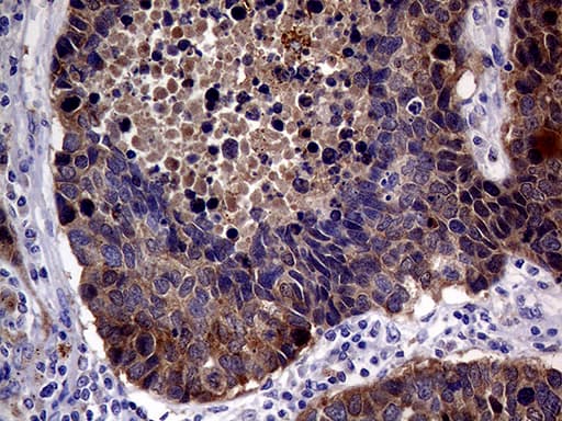 Monoclonal Mouse anti-Human p16INK4a / CDKN2A Antibody (clone OTI11A6, Carrier-free, IHC, WB)