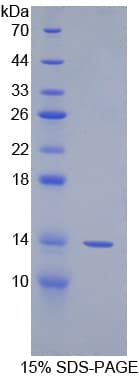 Human SPIN3 Protein (Recombinant His-S)