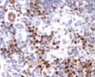 MKI67 / Ki67 Antibody (Internal)