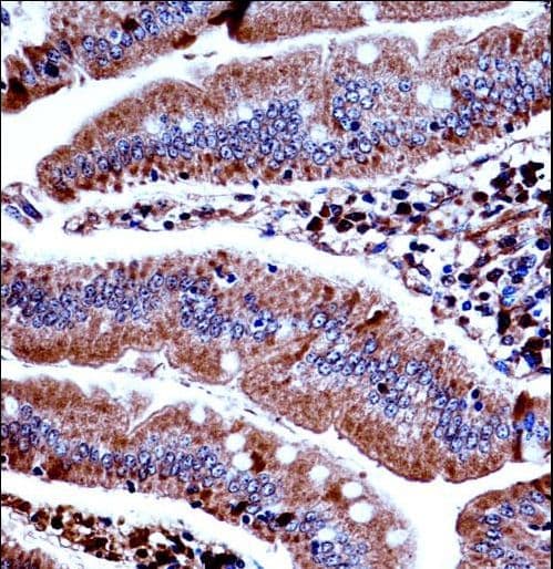 PKD3 / PRKD3 Antibody (aa221-249)