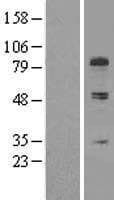 COL13A1 / Collagen XIII Protein (Over-Expression Lysate Myc-DDK (Flag))