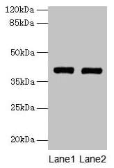 Polyclonal Rabbit anti-Human MAB21L1 Antibody (IHC, WB)