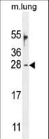 Polyclonal Rabbit anti-Human OAZ2 Antibody (aa125-151, IHC, WB)