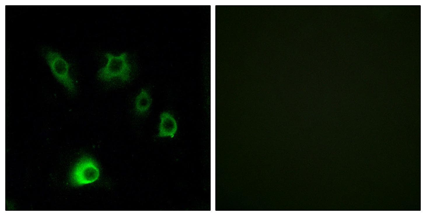 FGF18 Antibody