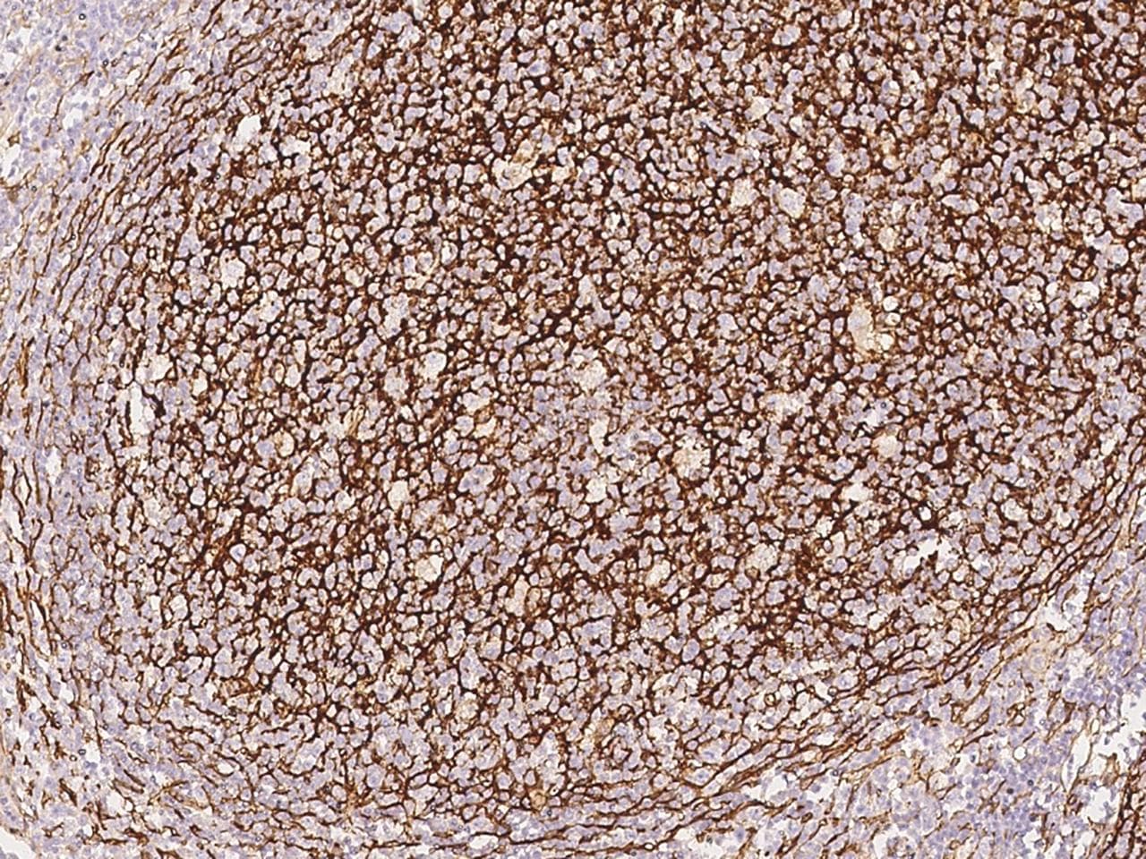 Monoclonal Mouse anti-Human VCAM1 / CD106 Antibody (clone 12, Preservative Free, IHC)
