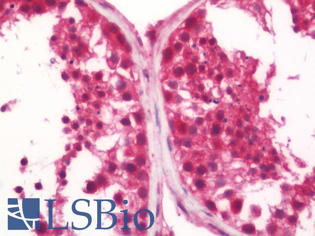 IHC-plus™ PLIN3 / M6PRBP1 / TIP47 Antibody (aa296-322)
