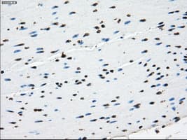 L1CAM Antibody (clone OTI2A6, Carrier-free)