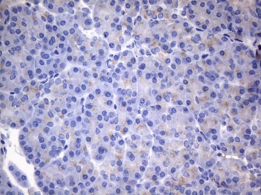CSF2 / GM-CSF Antibody (aa18-144, clone OTI6A3)