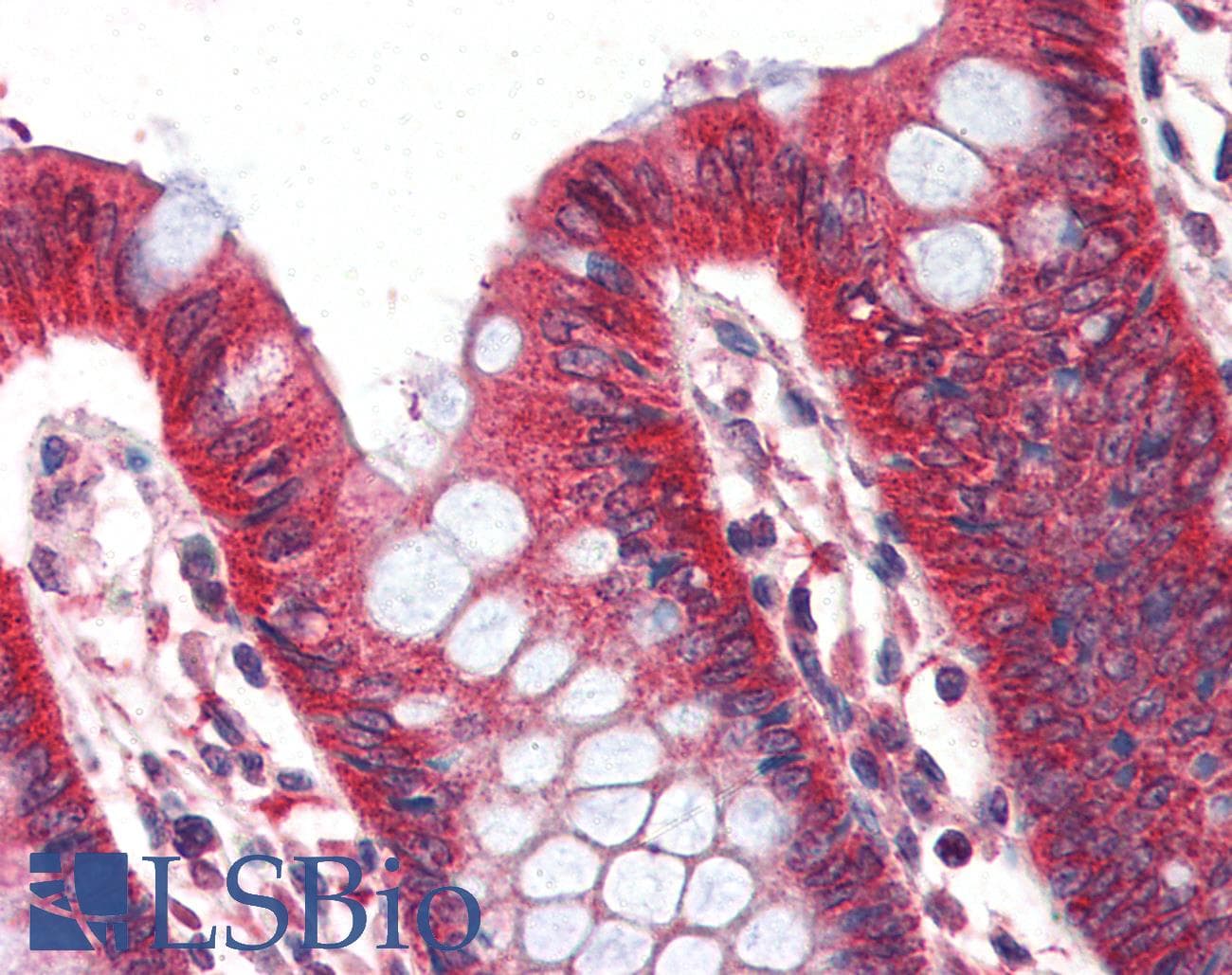 IHC-plus™ PLIN1 / Perilipin Antibody (aa488-499)