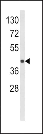 HLA-E Antibody (aa108-135)