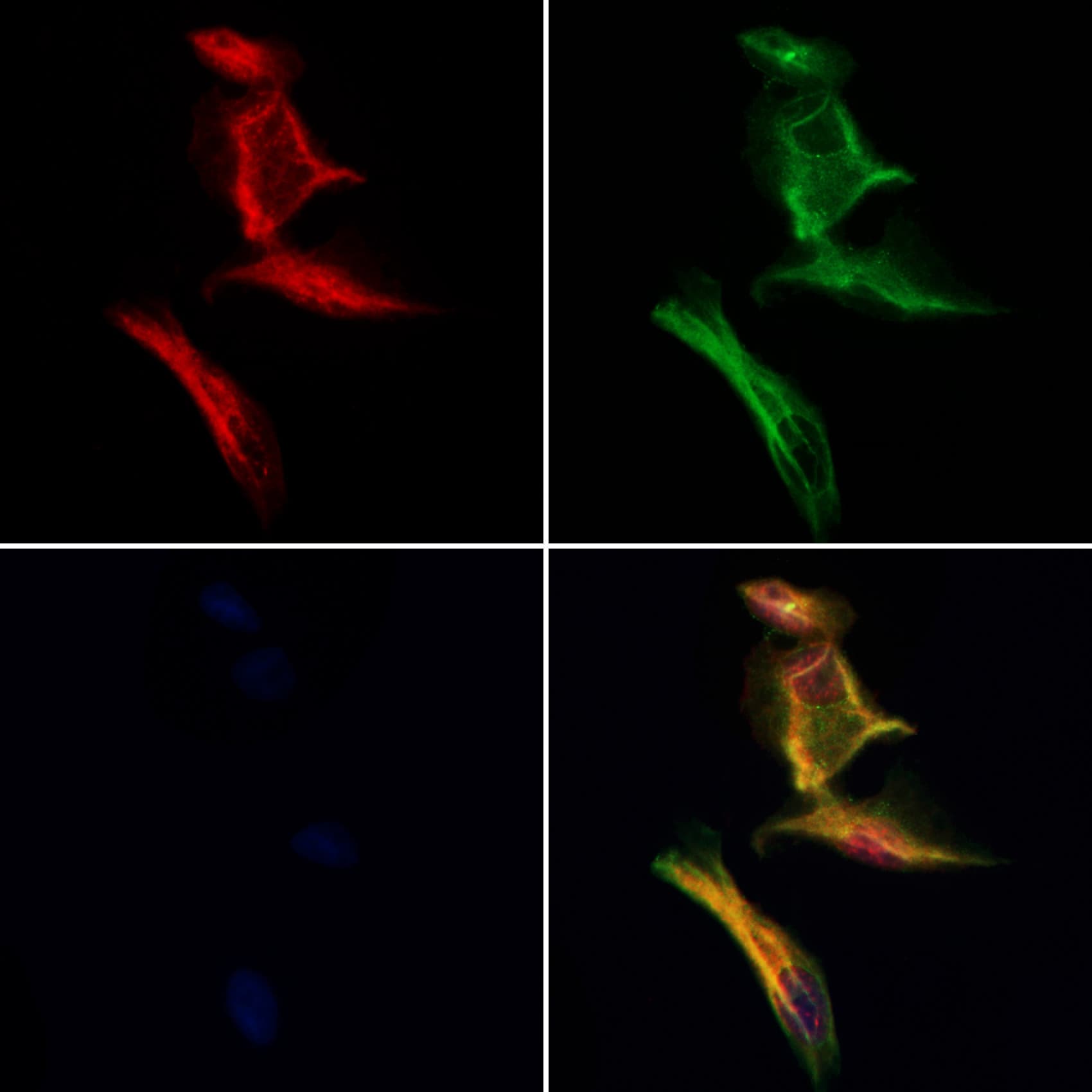 Polyclonal Rabbit anti-Human DMXL2 Antibody (IF, WB)
