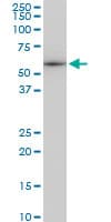 IHC-plus™ TUBB2A / Tubulin Beta 2A Antibody (clone 3C12)