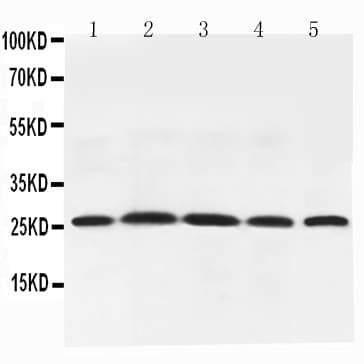 Polyclonal Rabbit anti-Rat Adiponectin Antibody (aa19-244, IHC, WB)