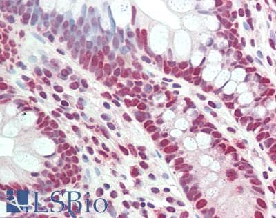 IHC-plus™ MAD2L1 / MAD2 Antibody (aa100-150)