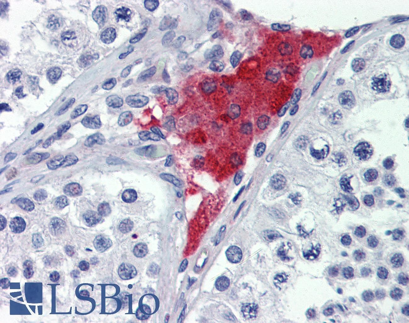 IHC-plus™ Polyclonal Rabbit anti-Human JPH4 Antibody (IHC, WB)