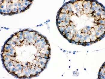 Polyclonal Rabbit anti-Human BAG2 Antibody (IHC, WB)
