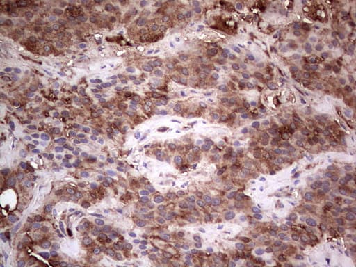 PKM2 Antibody (clone 12B9)