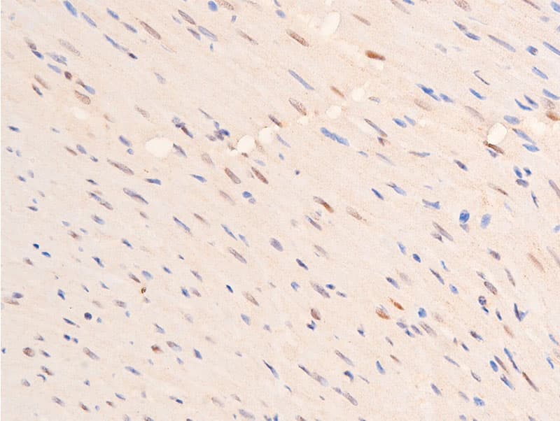 TP53 / p53 Antibody (phospho-Ser392)